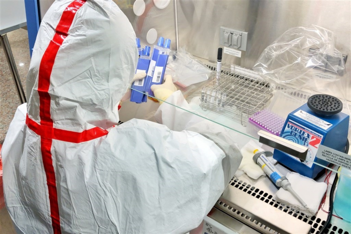 Taiwan develops PCR-based testing process to diagnose Langya virus